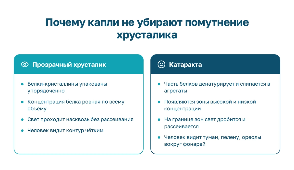 Схема: упорядоченные белки хрусталика пропускают свет, агрегаты денатурированного белка рассеивают его